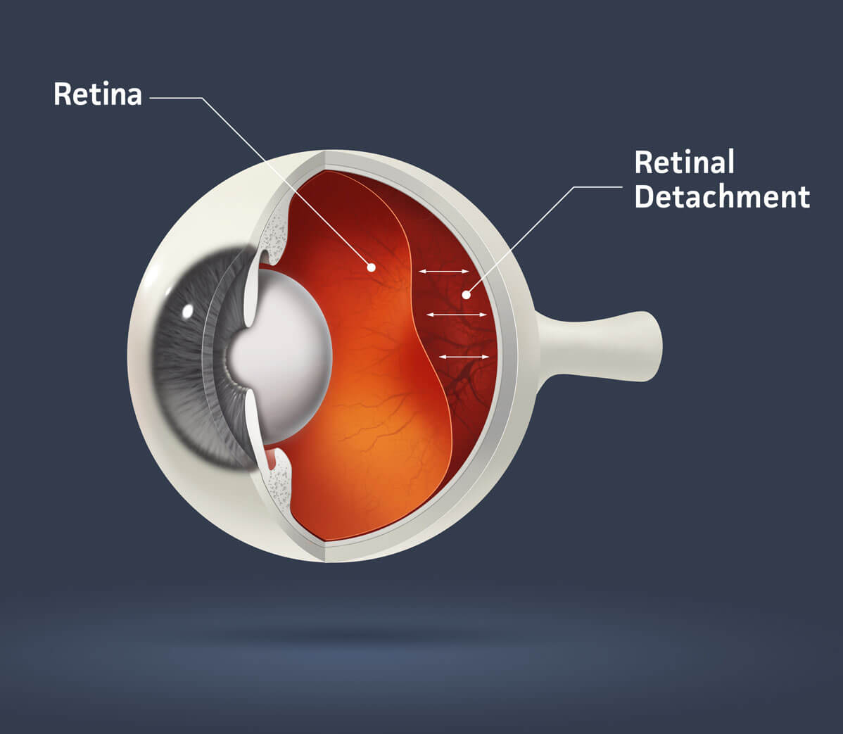 Retinal Evaluation